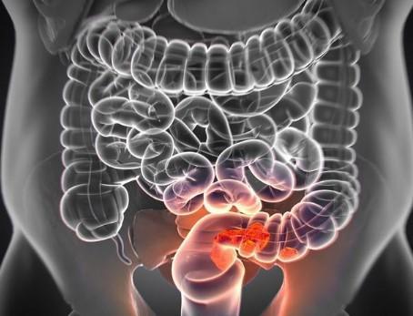 “排气”若有3种异常，最好去查一下，再拖下去，小心肠癌！