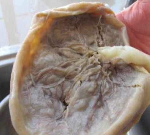 生完宝宝后,吃自己的胎盘补身体,你们的胎盘是怎么处理?