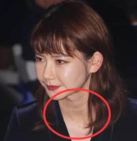 戚薇出现“整容”后遗症,网友:可能脖子才是戚薇原装的吧
