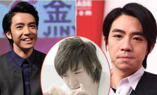 俞灏明因意外烧伤毁容，勇敢复出却被观众嘲笑，后台独自抹泪