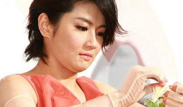 俞灏明因意外烧伤毁容，勇敢复出却被观众嘲笑，后台独自抹泪