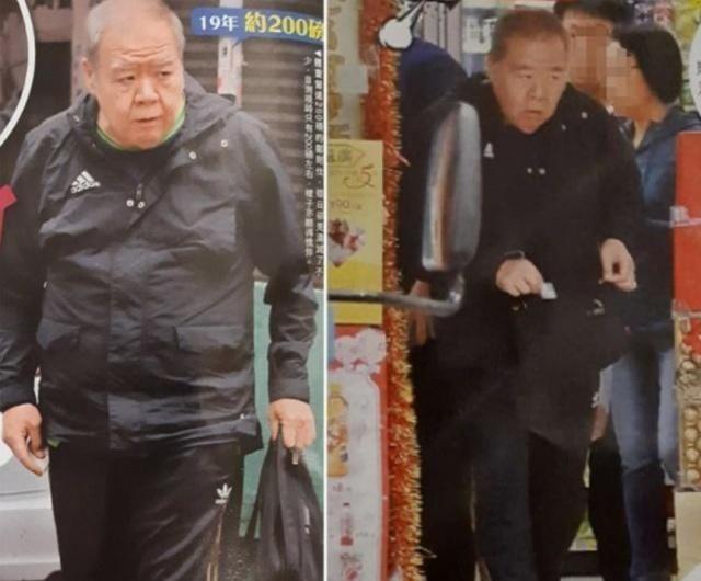 “肥猫”郑则仕因病1年瘦27斤，头发稀疏苍白，幸好妻子不离不弃