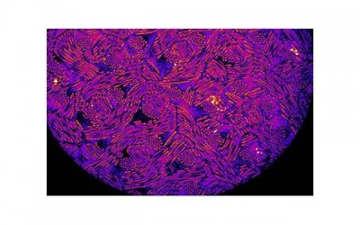 ​湿气最怕的“解药”不是薏米，而是它，湿气没了，小肚子不鼓了