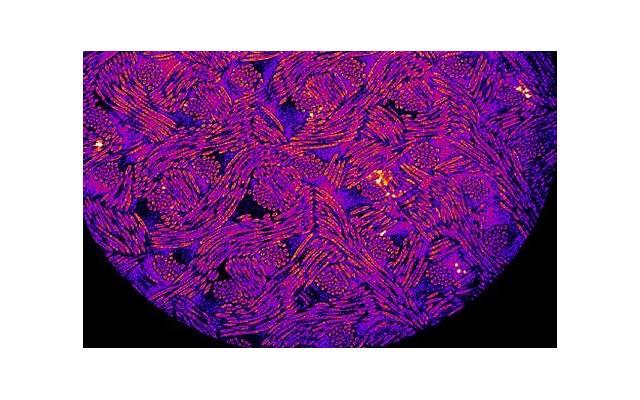 湿气最怕的“解药”不是薏米，而是它，湿气没了，小肚子不鼓了