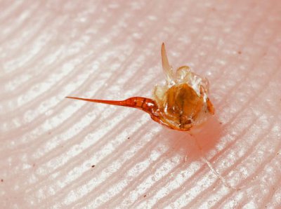 ​世界上最疼的昆虫叮咬蛰刺是什么？蜂还是蚁？咬在哪里最痛？