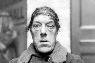 ​世界上最丑的女人：一生展览供人羞辱，年轻时照片令人感慨