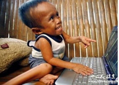 ​世界上四大最矮袖珍人，爱德华24岁仅0.7米，他们是如何活下来的