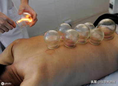 ​拔完火罐之后，不同的罐印代表什么？教你从罐印辨症