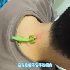 ​罕见！螳螂＂活生生＂的咬人还能治病？网友的神回复笑翻了